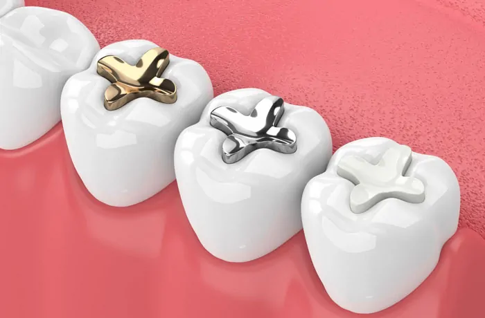 Dental Fillings Grandville Mi Dentist